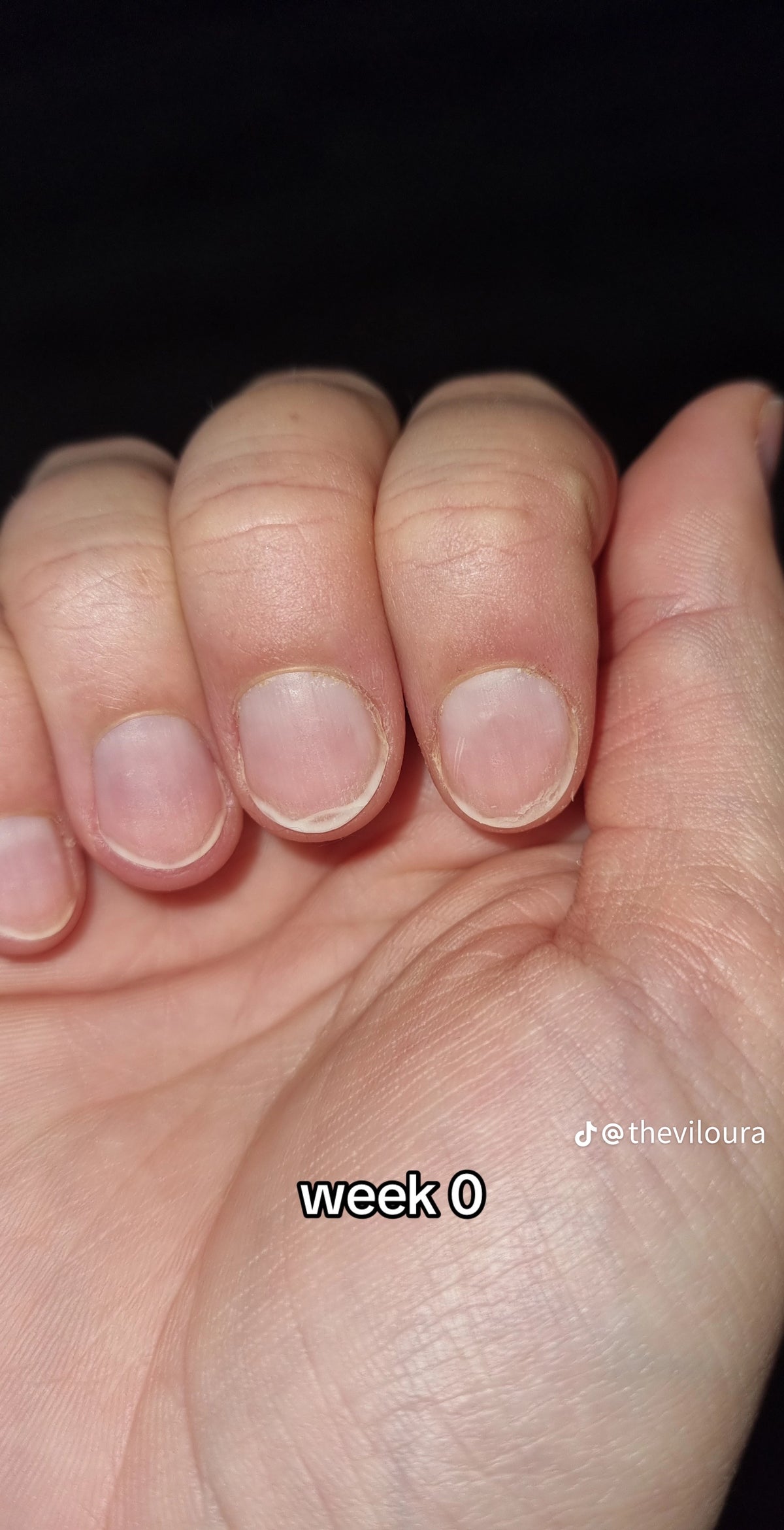 Soledad oil Nail